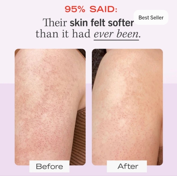 First Aid Beauty KP Bump Eraser Body Scrub x2 NEW NWT/NIB - Picture 6 of 8